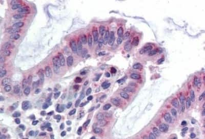 Immunohistochemistry-Paraffin: GCNT3 Antibody [NBP3-14331]